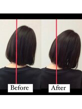 リトラ(Retra)/整体・BeforeAfter