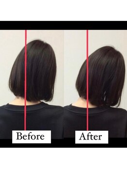 リトラ(Retra)/整体・BeforeAfter