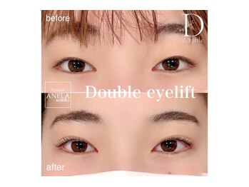 アネラ 仙台駅東口店(ANELA)/ダブルアイリフト