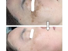 ベルネ(bellene)の雰囲気（ホームケアのアドバイスをさせて頂きます！）