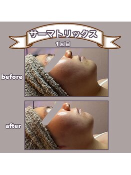 ビーマジック(美magic)/