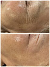 グランヴェルデ(GRAND VERDE)/素肌革命、始まる