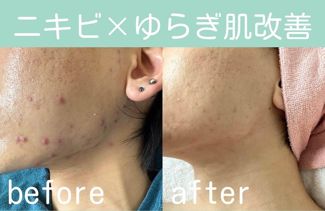 キワミ サーティスリー(kiwami33)｜ホットペッパービューティー