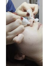 恵比寿脱毛 シーズ(She’s)/ダメージレスの優しい毛穴洗浄