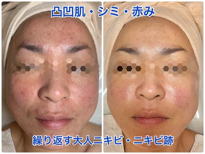 スハダボーテ(Suhada-beaute)の写真