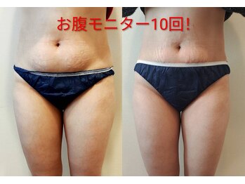 エムアールエイチ ウィズピービーピー(MRH withPBP)の写真/努力は2つ！通う事！暇な30分を耐える事！