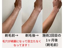 バニッシュ 川口店(VANISH)/こんなに変わる！