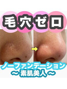 ジュリス(JURIS)/肌質改善で素肌美人に