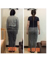 こおりやま整体院/ストレートネックお任せください