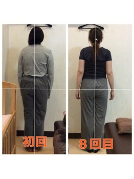 こおりやま整体院/ストレートネックお任せください