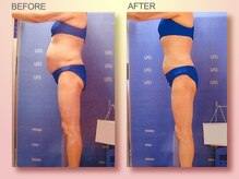 ジュリア オージェ 四条河原町店/ビフォーアフター（脂肪燃焼）