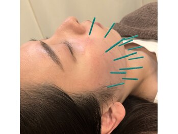 みかん鍼灸整骨院/美容鍼