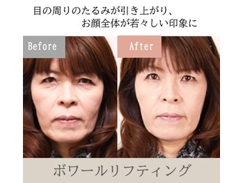 オワゾーブルー(Oiseaubleu)/ボワールリフティング・60代