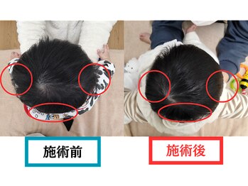 バランスアップラボ(バランスアップLAB)/★赤ちゃん整体　Before＆After2