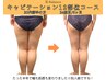 【健康的に痩せて引き締めたい】痩身キャビテーション3部位ｘ骨盤矯正3980円