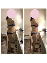 アクア エステティコ 亀有(ACQUA estetico)/脂肪燃焼