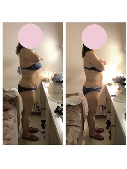 アクア エステティコ 亀有(ACQUA estetico)/脂肪燃焼