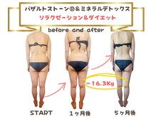 ラネージュ(LA NEIGE)の雰囲気（眼精疲労#ヘッドスパ#肩こり#腰痛#オイルマッサージ#腰痛#痩身）