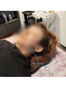 鍼灸院ネクストステップ(鍼灸院NextStep)/男の美容鍼!