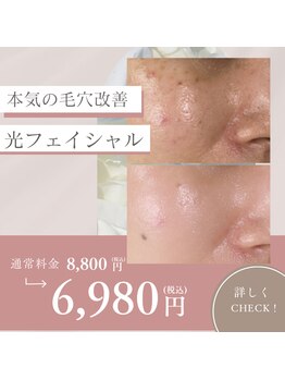 サロンドマナ(salon de MANA)/光フェイシャルで本気の毛穴改善