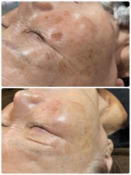 グランヴェルデ(GRAND VERDE)/一度で変わる、大人肌革命。