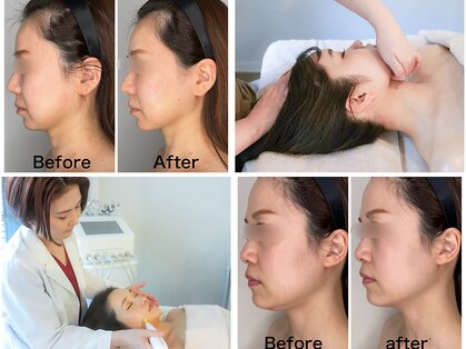 ケイ(Kei)の写真