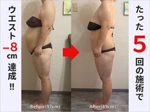 骨盤矯正ダイエット×姿勢矯正であなたも理想の体型が手に入る！