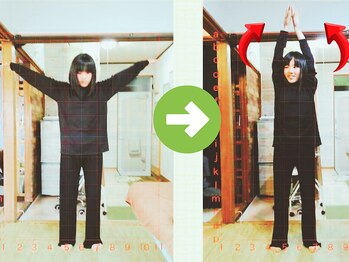 サプライズ整体院/20代ママさんの肩こり初回結果