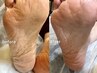 【フットメニューに＋】角質除去10分＋パック