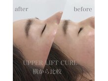 コンジュ ファースト 土橋店(CONJU 1st)/アッパーリフトカール　4950円