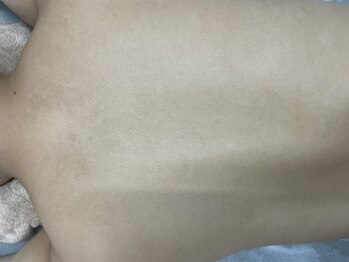 ナノハナ/鹿沼市全身脱毛美容室ナノハナ