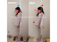 ピエール ナリタイラボ 薬院店(Piel NARITAI LABO)/気になる猫背がすっきり♪