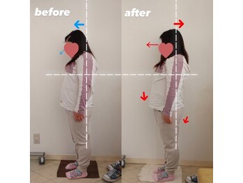 ピエール ナリタイラボ 薬院店(Piel NARITAI LABO)/気になる猫背がすっきり♪