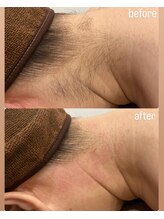 シュバル(CHEVAL)/うなじ美人になりませんか？