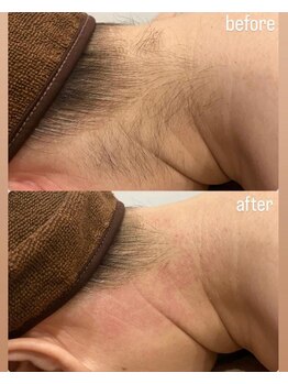 シュバル(CHEVAL)/うなじ美人になりませんか？