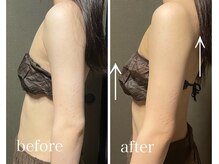 イーストモア(EAST MOIS)/バストケア一回の効果