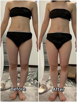 輝 らいと/ビフォーアフター(正面)