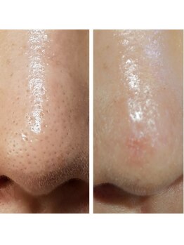 ウェリナベル(WelinaBelle)/ララピール