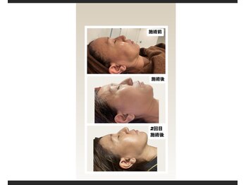 サロン シャンティー/2回の変化