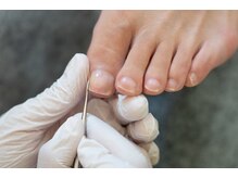 フットスタースマイルの雰囲気（巻爪・足の爪が上手く切れないといったお悩みご相談ください）