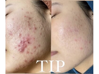 ノヴェイル(NoVeil)の写真