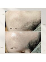 ビー ファクトリー(B FACTORY)/フェイシャルワックス