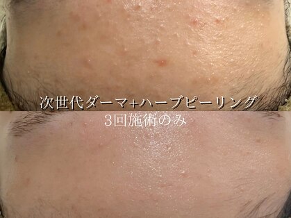 ライリー(Rairy)の写真