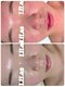 リラ(LiLas)の写真/最新の皮膚理論とリアボーテ幹細胞導入で、原因から一緒に向き合うケア◎