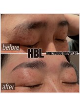 オルト(Orto)/ハリウッドブロウリフト