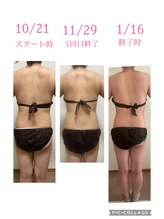 ララ(Rala)/ブライダルエステ3ヶ月　背中