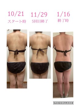 ララ(Rala)/ブライダルエステ3ヶ月 背中