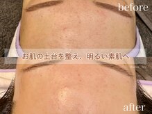 リリー(Liry)の雰囲気（くすみを飛ばして透明な素肌へ。季節による肌悩みも解消◎）