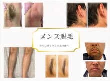 メンズブリリアンス(MEN’s BRILLIANCE)の雰囲気（☆ワックス脱毛☆ 人気のVIOからボディ・フェイスまで全カバー！）