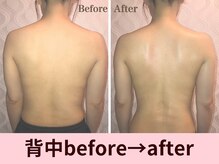 クイーンズチャーム(Queen's Charm)/パワーツリー背中before→after